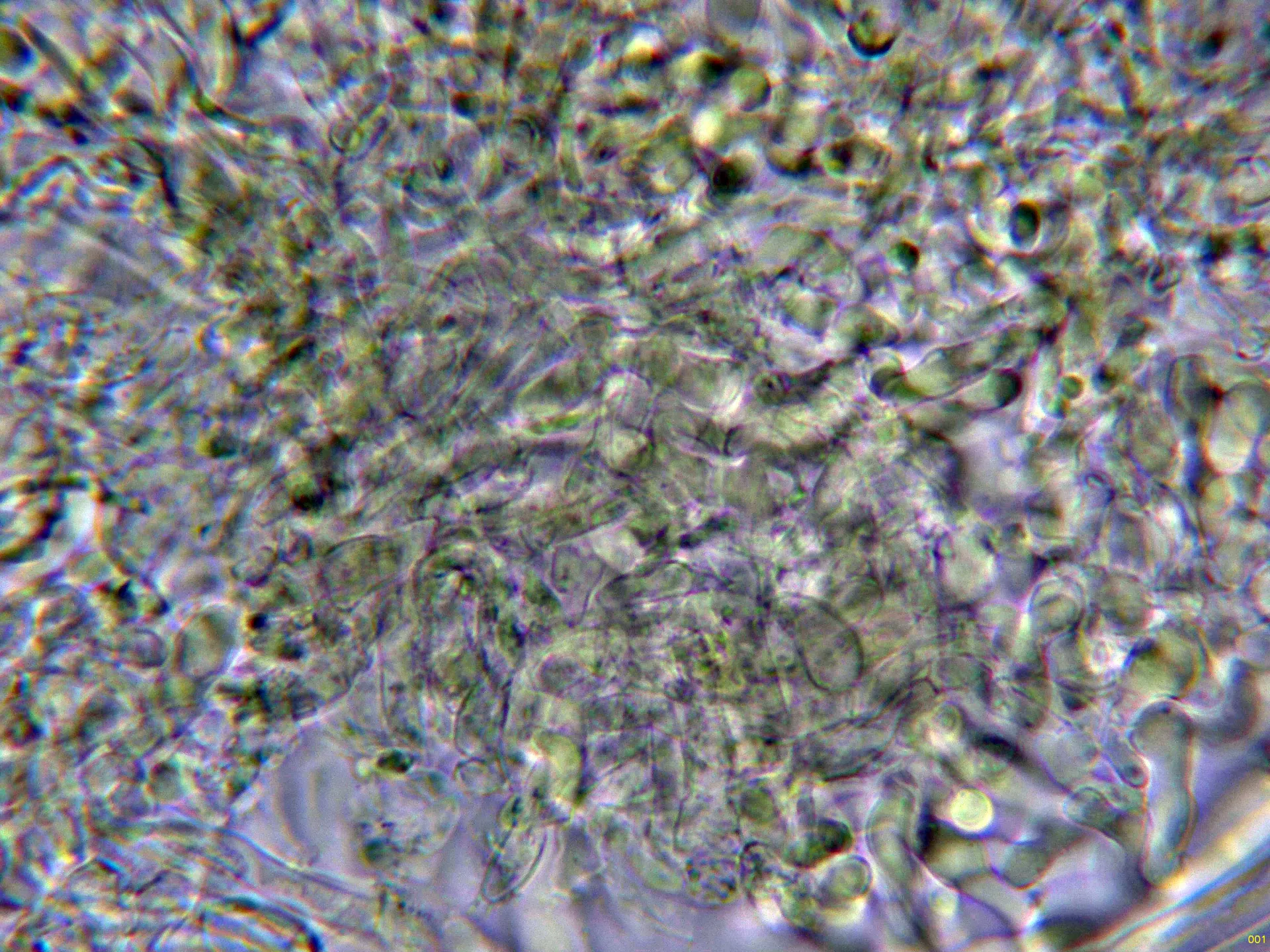 4 - Excipulo medular Melzer-001